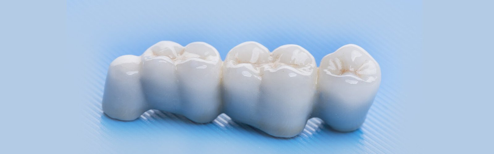 Dental Crowns and Bridge